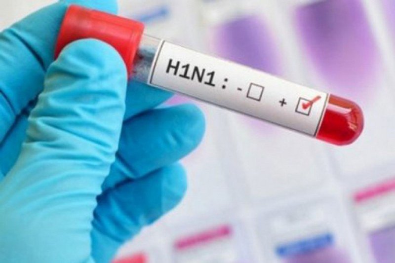 Državljanka Srbije preminula od virusa H1N1 u Bahreinu