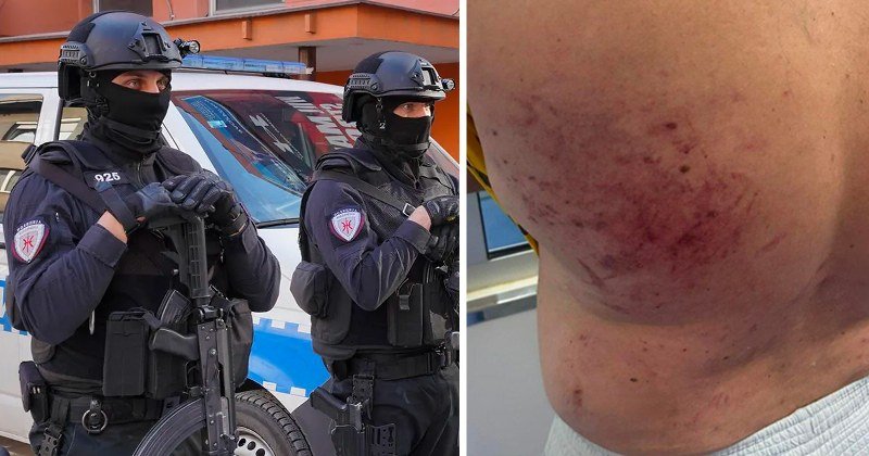 MUP za vikend mlatio po gradu. Policajci sa fantomkama koristili palice i elektrošokove? (Foto/Video)